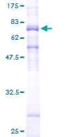 Human HDAC8 Protein (Recombinant GST)