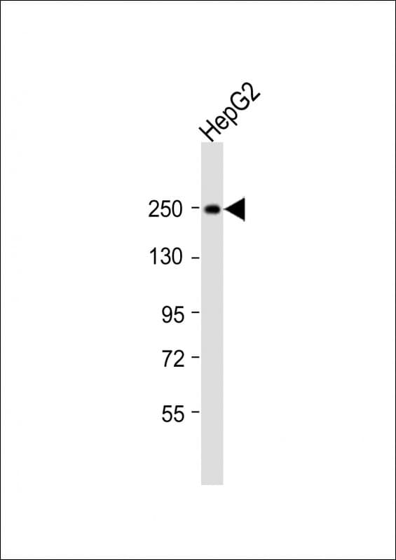MYO5B / Myosin VB Antibody (aa7-30)