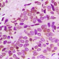 GNL3L Antibody (Internal)