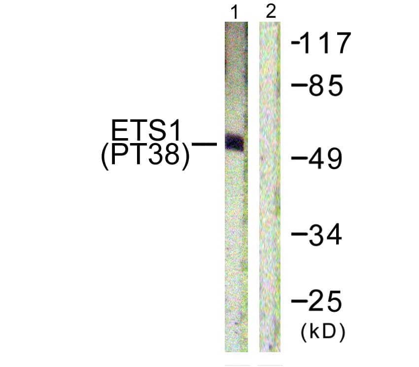 ETS1 / ETS-1 Antibody (phospho-Thr38)