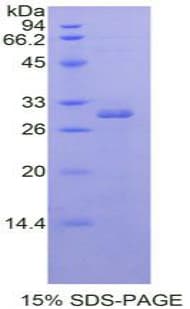 Human RORA / ROR Alpha Protein (Recombinant His-T7)