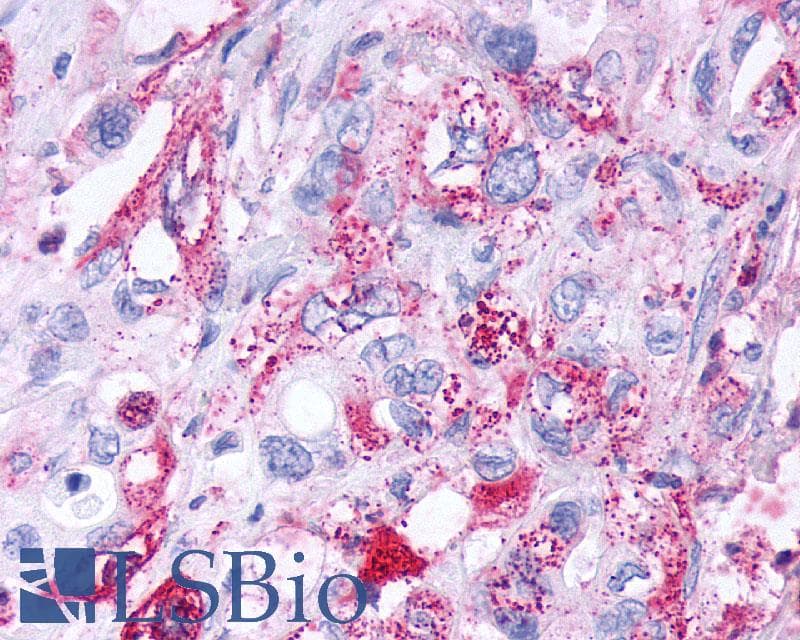 PathPlus™ Polyclonal Rabbit anti-Human CRHR2 / CRF2 Receptor Antibody (Extracellular Domain, IHC)