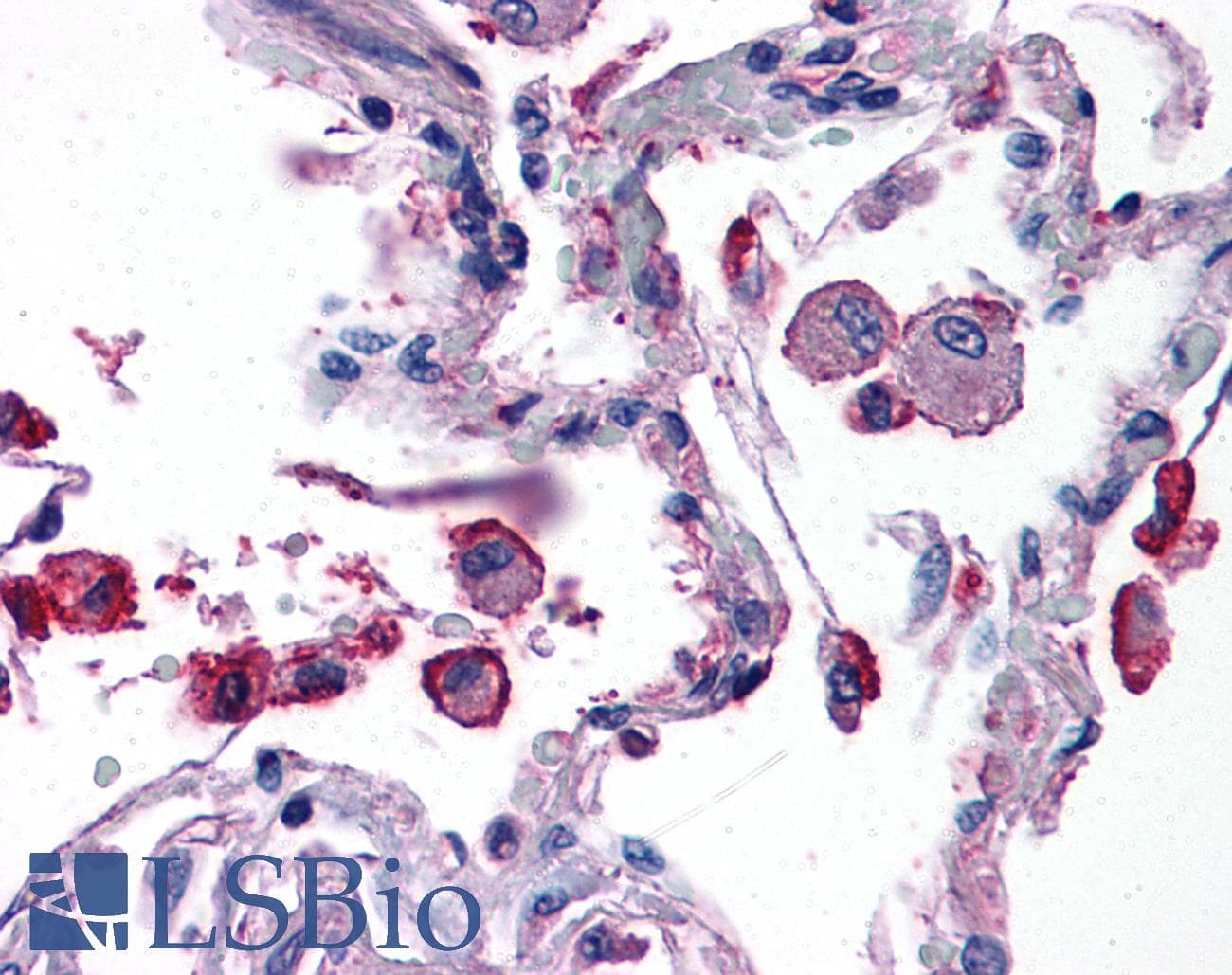 IHC-plus™ TRIM7 Antibody (aa209-221)