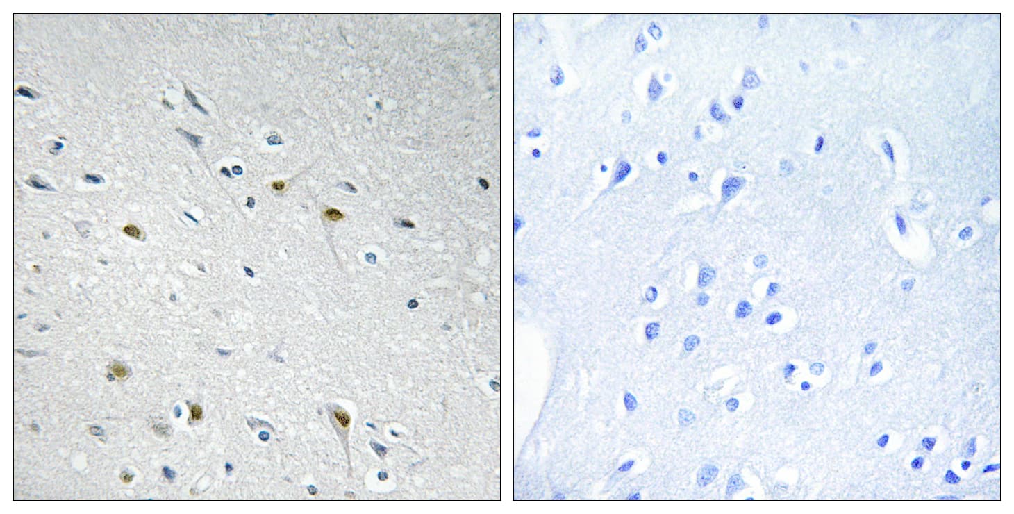 Polyclonal Rabbit anti-Human CDC25C Antibody (aa14-63, IHC, IF)