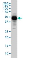 IHC-plus™ Neuroserpin Antibody (clone 1D10)