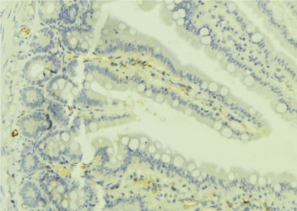 RAB32 Antibody