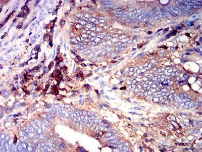 ADGRE5 / CD97 Antibody (clone 6D7E6)