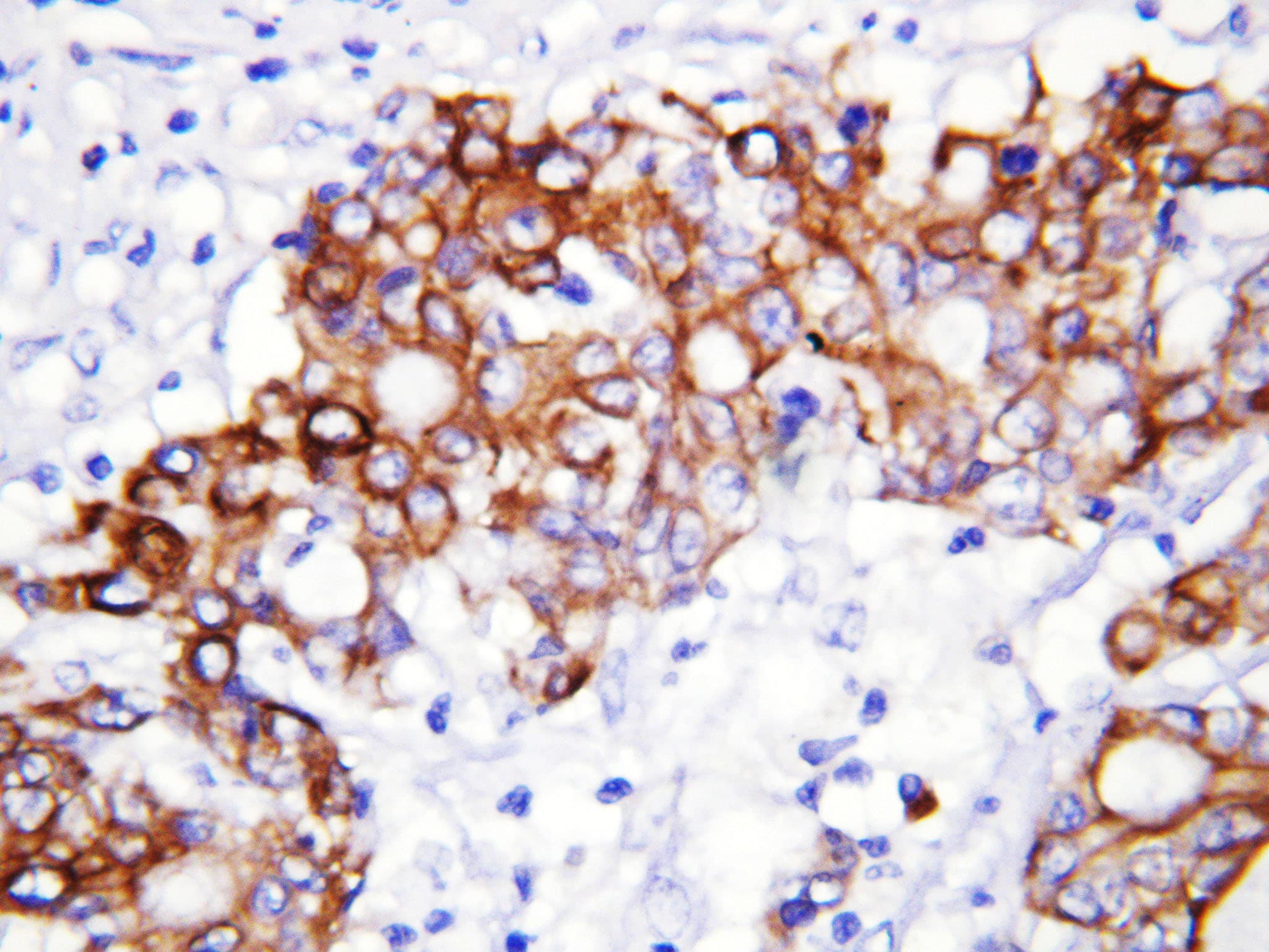GCLC Antibody (aa7-24)