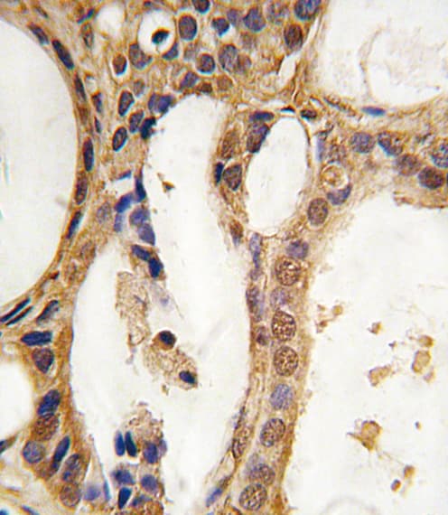 Polyclonal Rabbit anti-Human PIM1 / Pim-1 Antibody (IHC, WB)