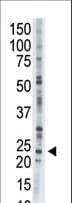 AK1 / Adenylate Kinase 1 Antibody (aa165-194)