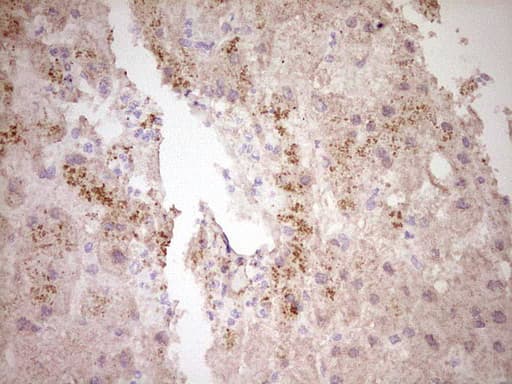 Monoclonal Mouse anti-Human CTGF Antibody (clone OTI2C9, aa27-349, IHC)