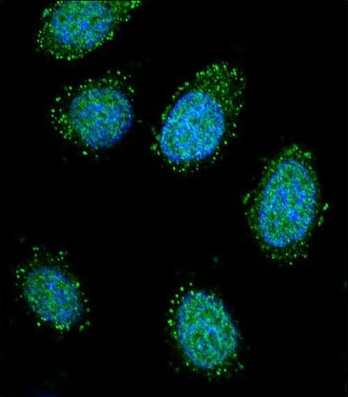 Polyclonal Rabbit anti-Human DTNA / Dystrobrevin Alpha Antibody (aa692-721, IHC, IF, WB)