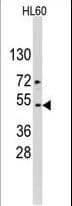 Polyclonal Rabbit anti-Human ACTB / Beta Actin Antibody (aa189-218, IHC, WB)