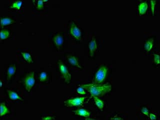Polyclonal Rabbit anti-Human MYO10 / Myosin-X Antibody (IHC, IF)