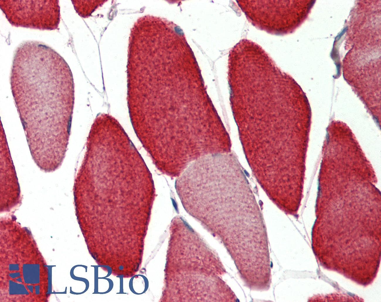 IHC-plus™ VAMP2 / VAMP-2 Antibody (aa1-66)