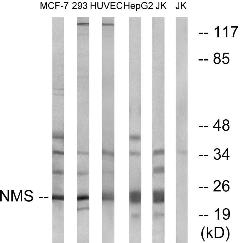 Polyclonal Rabbit anti-Human NMS Antibody (aa104-153, WB)