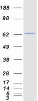 Human ACAD9 Protein (Recombinant Myc-DDK (Flag))