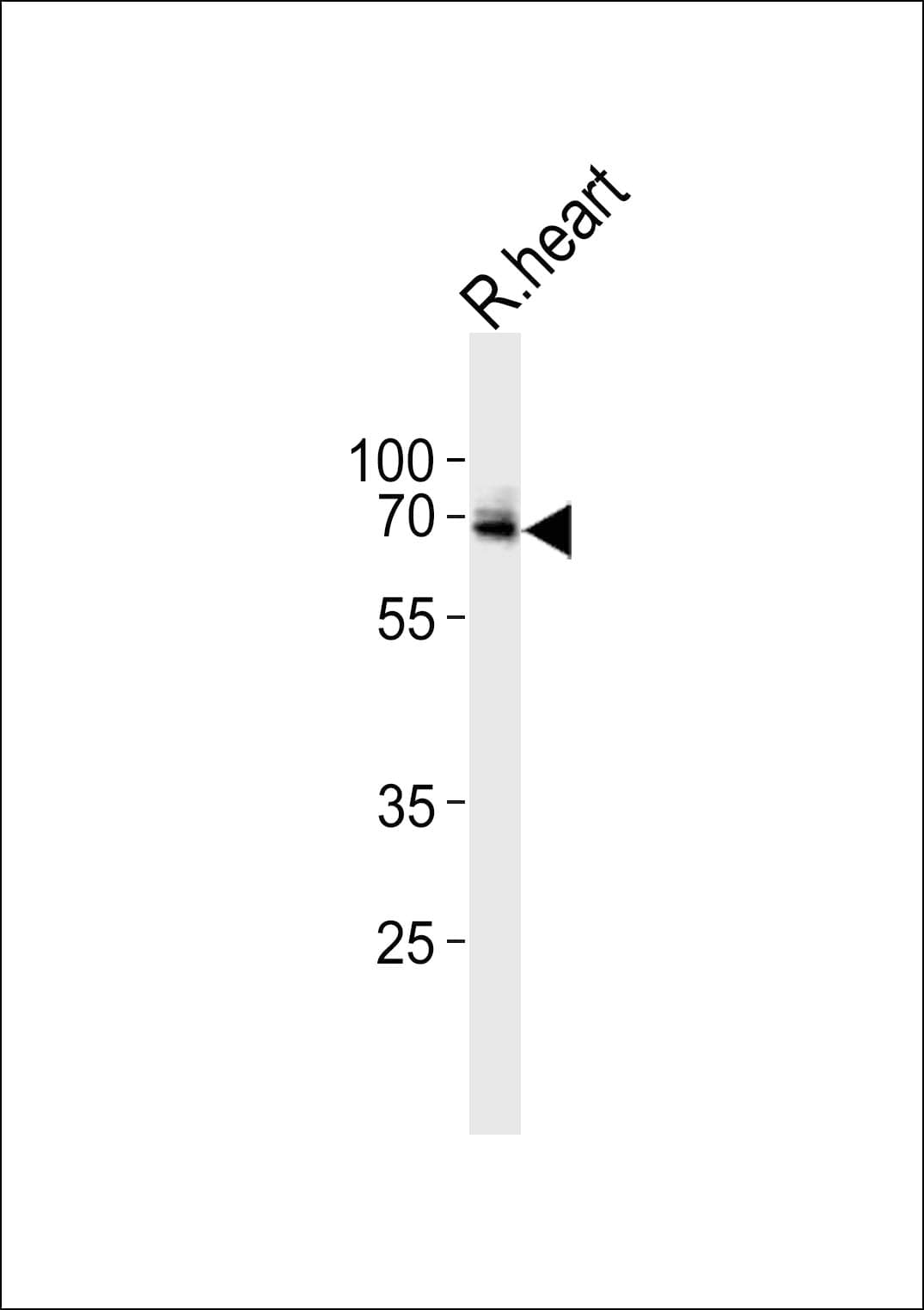 USP2 Antibody (aa71-101)
