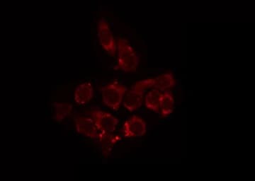 SLC25A11 Antibody