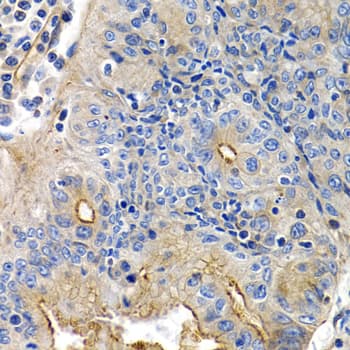 PTGIR / IP Receptor Antibody