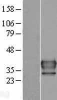 NAT6 / FUS2 Protein (Over-Expression Lysate Myc-DDK (Flag))