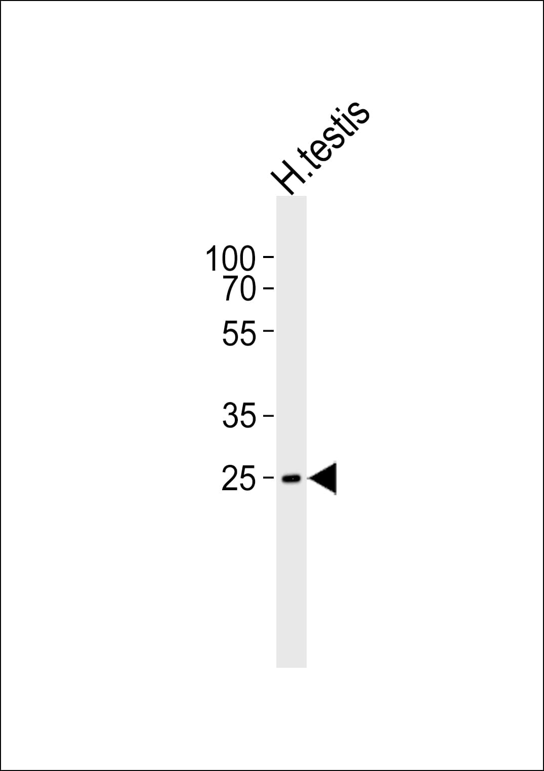 STPG1 Antibody (aa238-272)