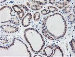 TBC1D21 Antibody (clone OTI1A8)