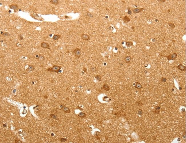MAP1B Antibody