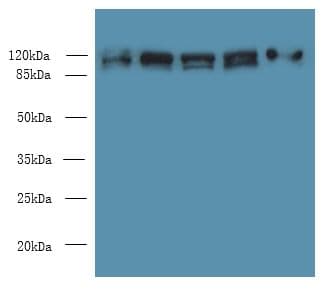 COPB1 / Beta-COP Antibody