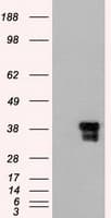 DFFA / ICAD / DFF45 Antibody (clone OTI1B10)