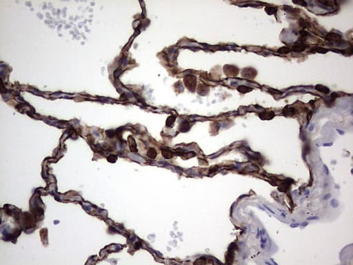 KRT19 / CK19 / Cytokeratin 19 Antibody (aa240-390, clone OTI7H7)