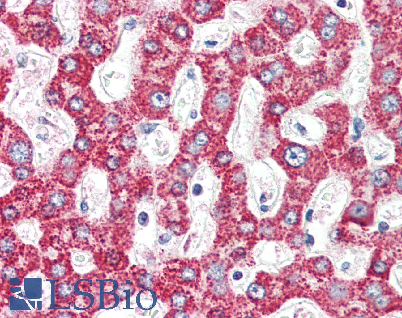 IHC-plus™ MCAD / ACADM Antibody (aa441-454)