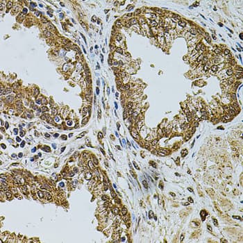 CREBBP / CREB Binding Protein Antibody