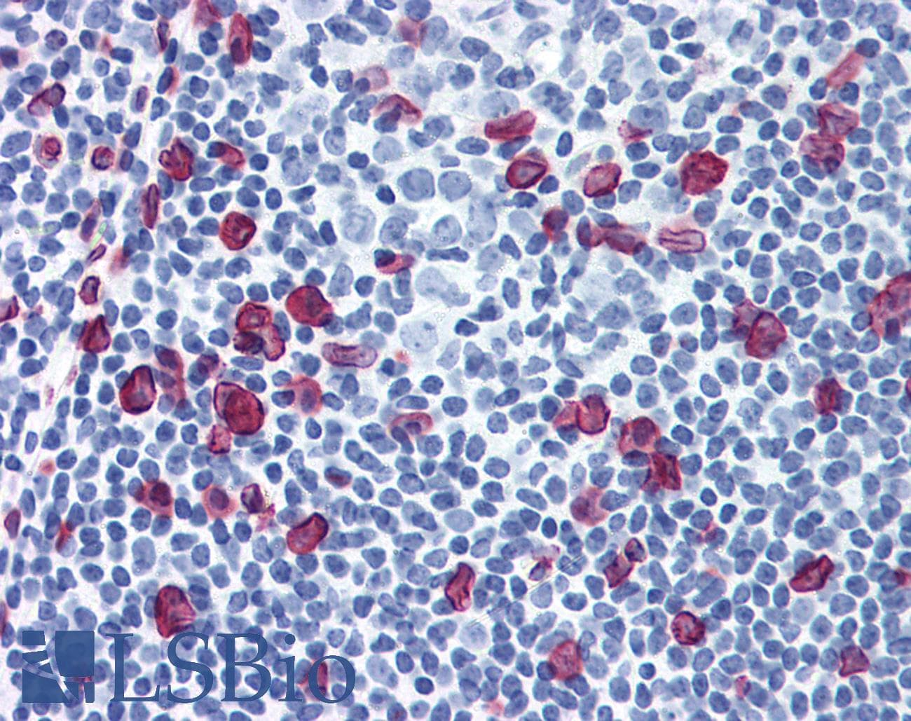 PathPlus™ LMNA / Lamin A+C Antibody (aa464-572, clone JOL2)