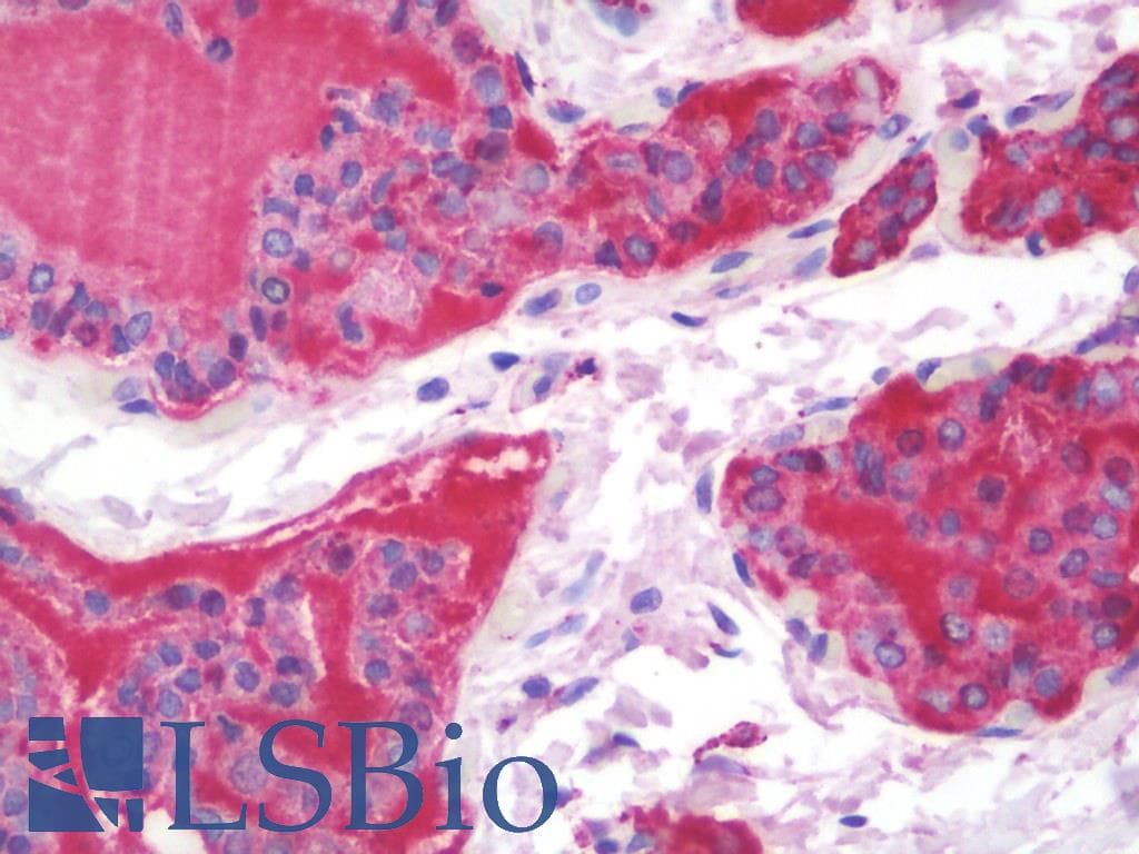 IHC-plus™ CALR / Calreticulin Antibody