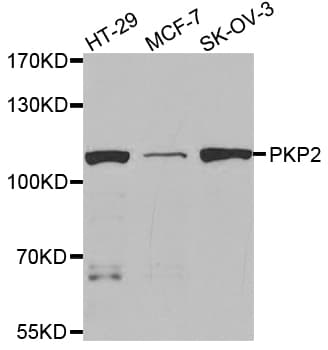 IHC-plus™ Polyclonal Rabbit anti-Human PKP2 / Plakophilin 2 Antibody (IHC, WB)