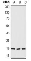Polyclonal Rabbit anti-Human DUX5 Antibody (N-Terminus, WB)