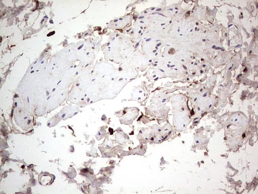 Monoclonal Mouse anti-Human LGALS3 / Galectin 3 Antibody (clone OTI15E4, IHC, WB)