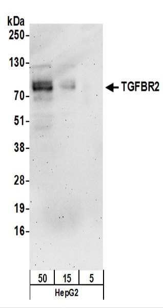 PathPlus™ TGFBR2 Antibody (aa517-567)