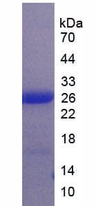 Human LILRB3 Protein (Recombinant His-T7)
