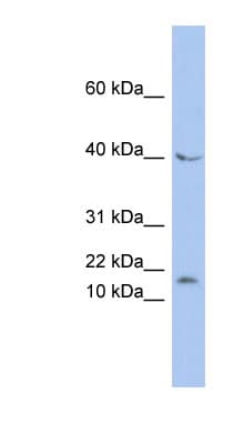 MAX Antibody (N-Terminus)