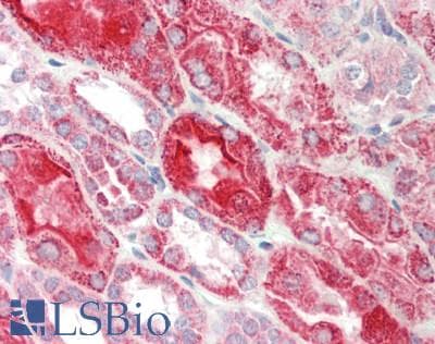 Polyclonal Rabbit anti-Rat LRP2BP / LRP2 Binding Protein Antibody (aa201-250, IHC, WB)