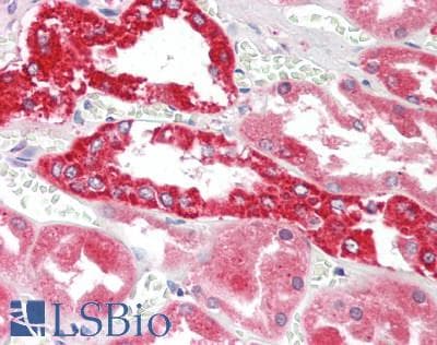 IHC-plus™ ITGAE / CD103 Antibody
