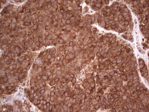 RET Antibody (aa713-1017, clone OTI20B8)