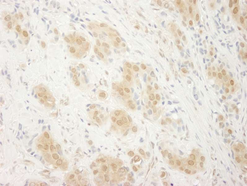 MAPK1 / ERK2 Antibody (aa310-360)