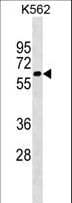 CAT / Catalase Antibody (aa152-180)