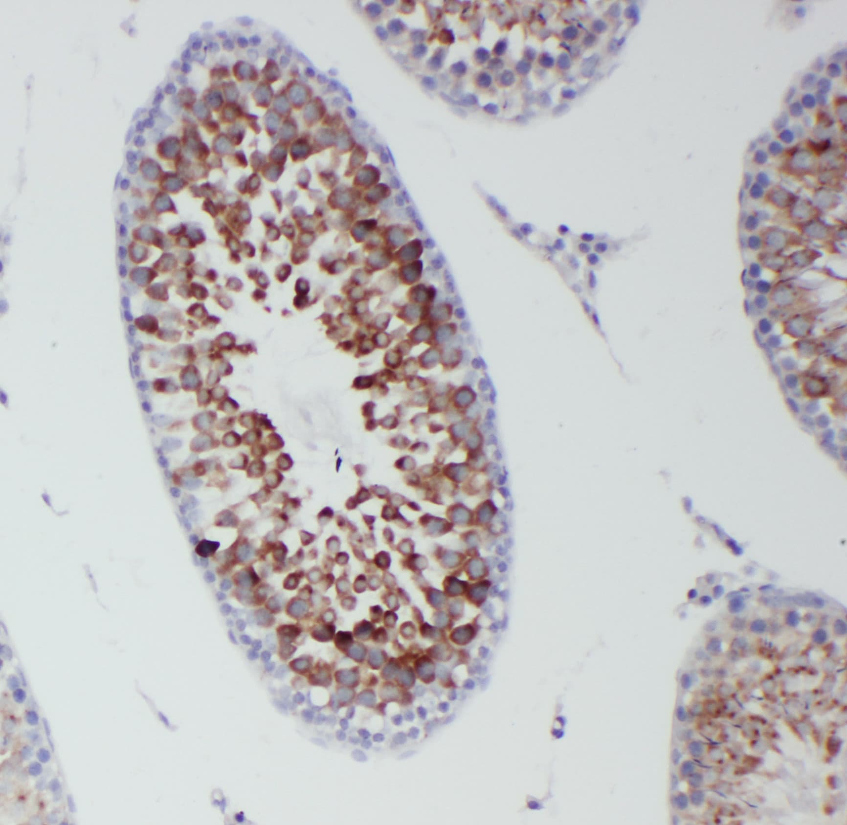 DDX4 / VASA Antibody (aa253-272)