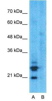 EMA / MUC1 Antibody (aa1192-1241)
