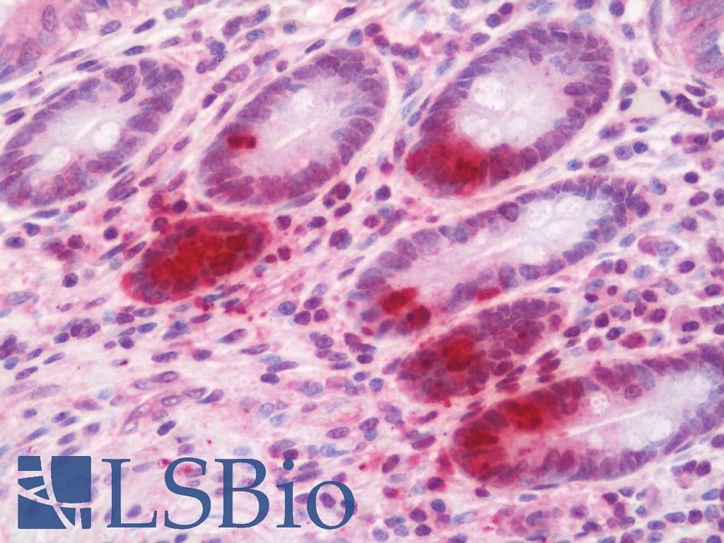 IHC-plus™ PGK1 / Phosphoglycerate Kinase Antibody