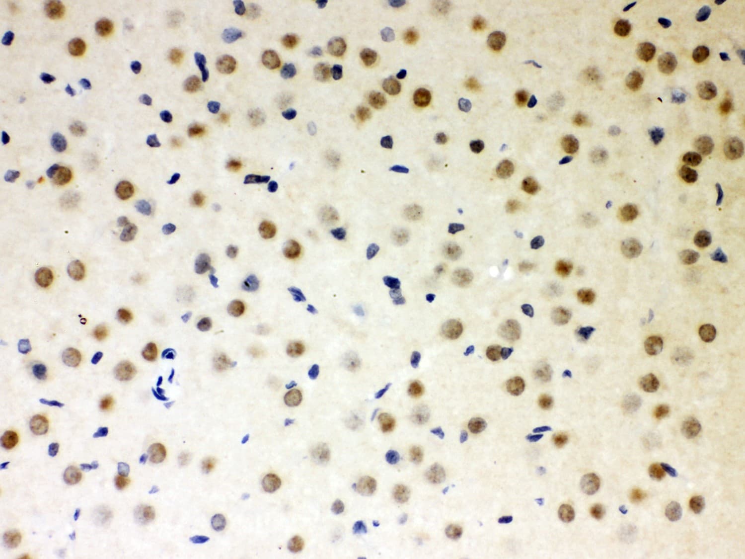 PRKCI / PKC Iota Antibody (aa21-214)